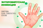 Энтеровирусная терапия